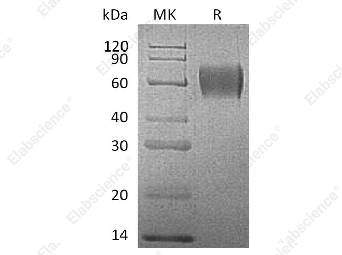 Recombinant Human IL17RA Protein (His Tag) - 1