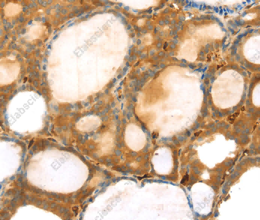 TMPRSS11F Polyclonal Antibody - 2