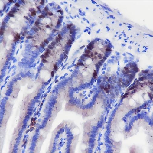 Recombinant TPX2 Monoclonal Antibody-searchlist-1