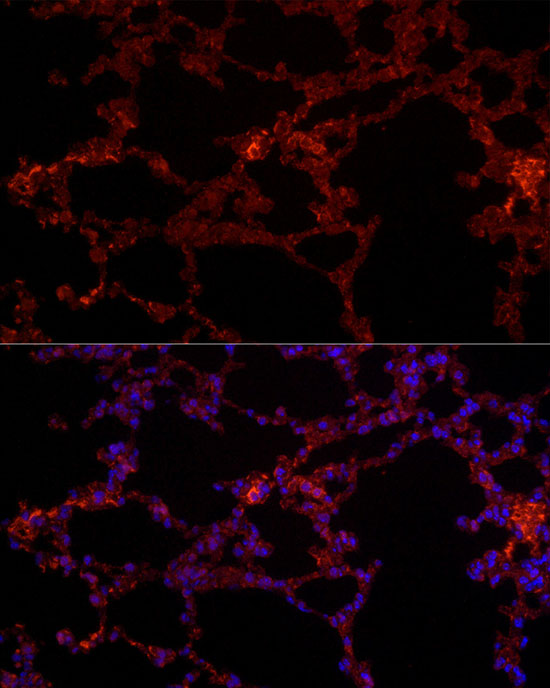 Immunofluorescence analysis of mouse lung cells using NLRC4 Polyclonal antibody at dilution of 1:100 (40x lens). Blue: DAPI for nuclear staining.