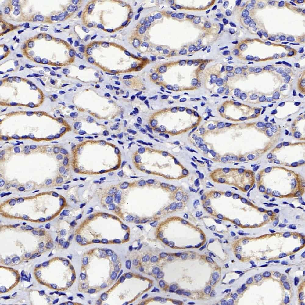 Immunohistochemistry analysis of paraffin-embedded human kidney  using DICER1 Polyclonal Antibody at dilution of 1:400.