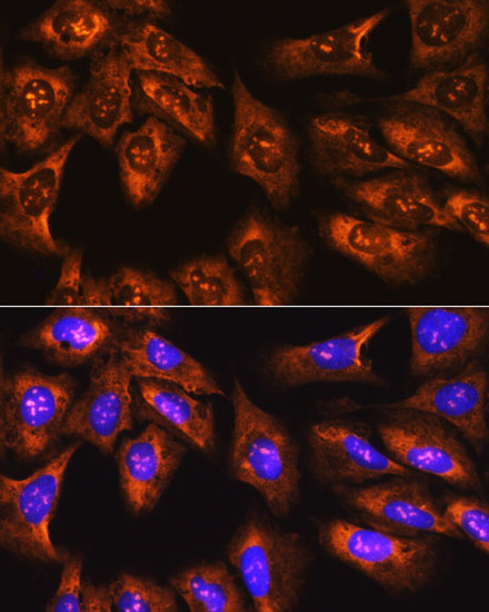 Immunofluorescence analysis of U-2 OS cells using RPS3 Polyclonal Antibody at dilution of 1:100. Blue: DAPI for nuclear staining.