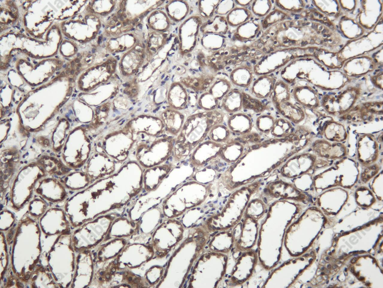 Recombinant RAB4A Monoclonal Antibody - 2