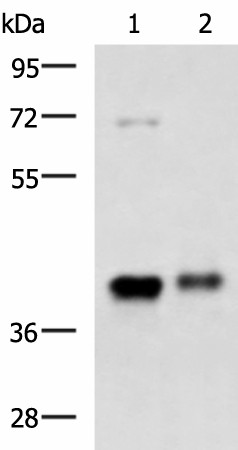 Western blot analysis of Mouse brain tissue and Human fetal brain tissue lysates  using GNAZ Polyclonal Antibody at dilution of 1:1300