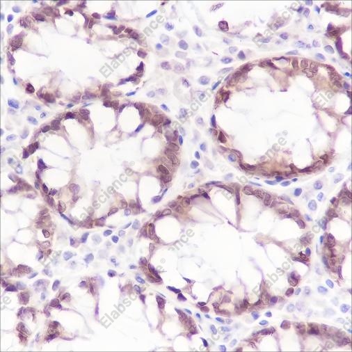 Recombinant Caspase-7 Monoclonal Antibody - 3