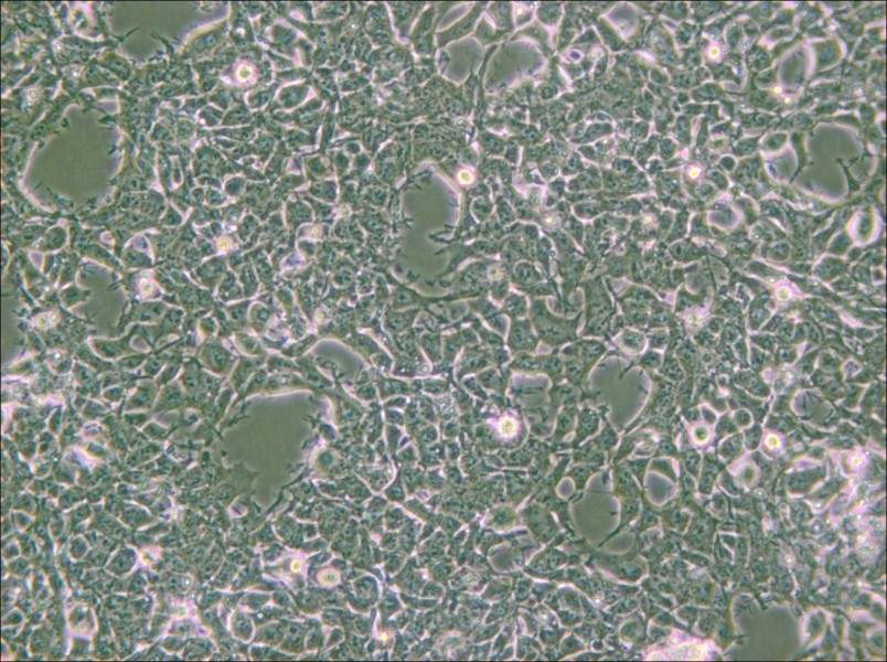 2V6.11 Cell Complete Medium - 4