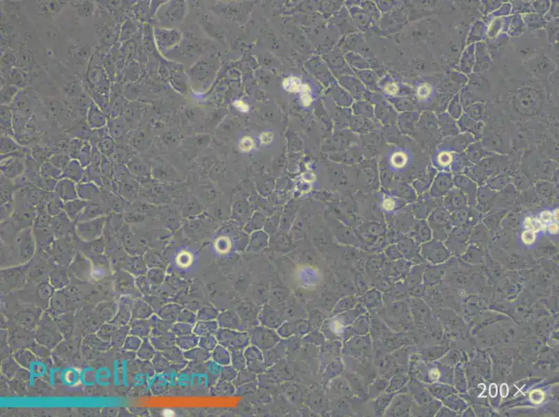 OVCAR-5 Cell Complete Medium - 6