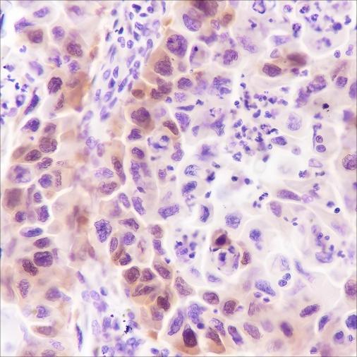 Recombinant Stathmin Monoclonal Antibody - 2