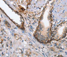 MAD2L1BP Polyclonal Antibody - 3