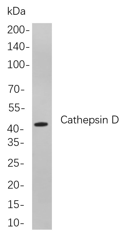 Recombinant Cathepsin D Monoclonal Antibody-searchlist-1