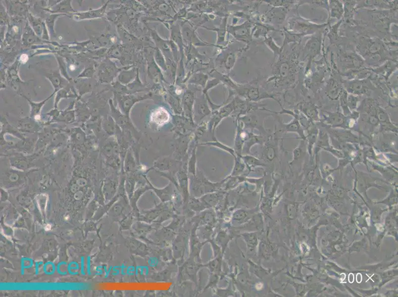 Tb 1 Lu Cell Complete Medium - 5