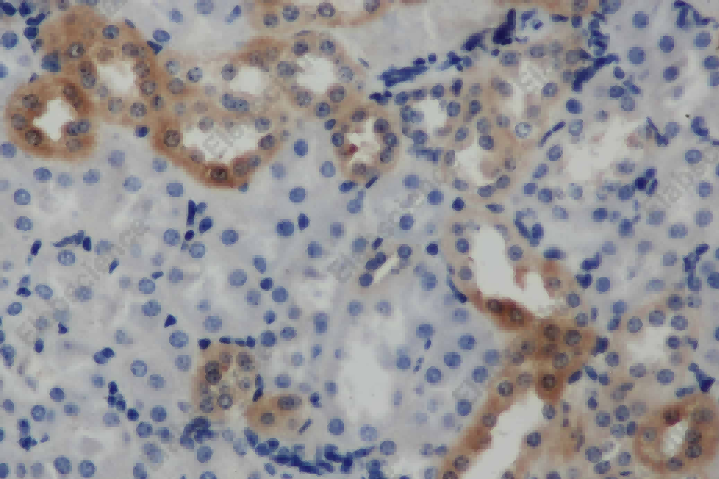 ARF6 Polyclonal Antibody - 2