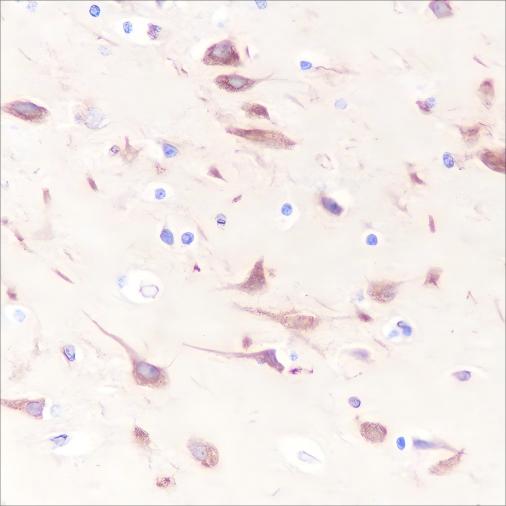 Recombinant BAP29 Monoclonal Antibody - 2