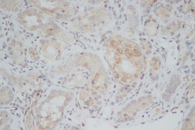 Immunohistochemistry of paraffin-embedded Rat kidney using ERG Polyclonal Antibody at dilution of 1:50