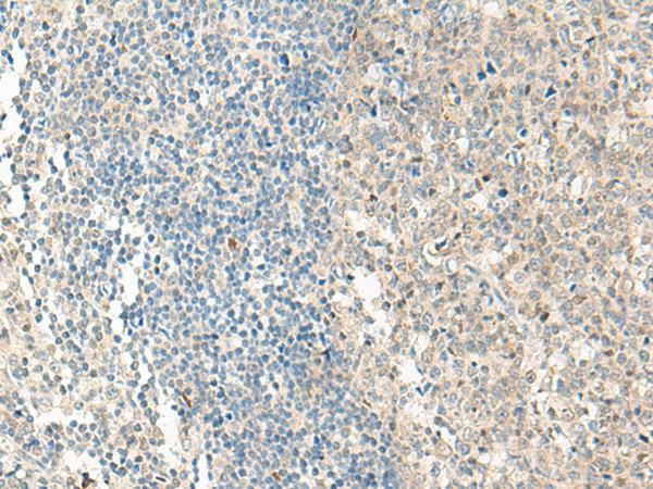 Immunohistochemistry of paraffin-embedded Human tonsil tissue  using NPBWR1 Polyclonal Antibody at dilution of 1:50(?200)