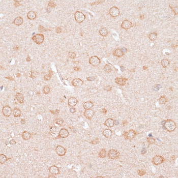 Immunohistochemistry of paraffin-embedded Rat brain using KCNJ4 Polyclonal Antibody at dilution of  1:100 (40x lens).