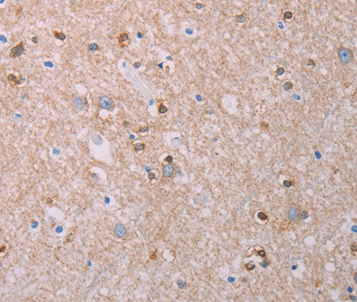 Immunohistochemistry of paraffin-embedded Human brain tissue using AKT2 Polyclonal Antibody at dilution 1:70