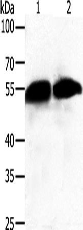 Western Blot analysis of Human fetal liver tissue and A549 cell using GC Polyclonal Antibody at dilution of 1:500