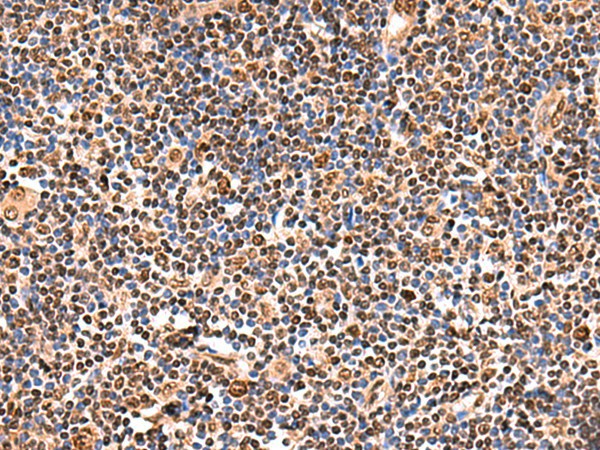 Immunohistochemistry of paraffin-embedded Human tonsil tissue  using GPKOW Polyclonal Antibody at dilution of 1:140(?200)