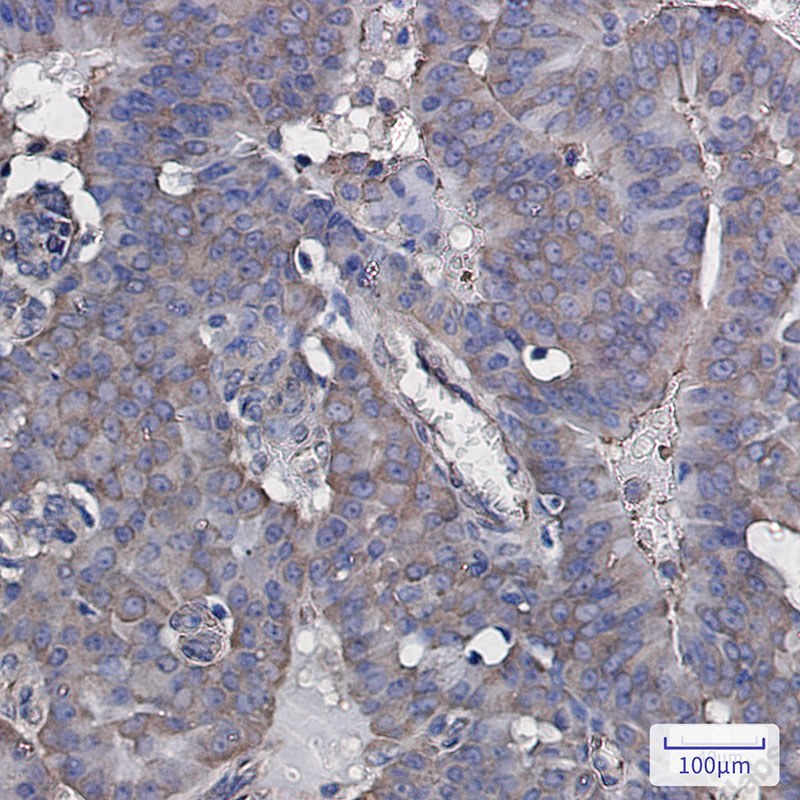 Recombinant eIF3B Monoclonal Antibody - 2