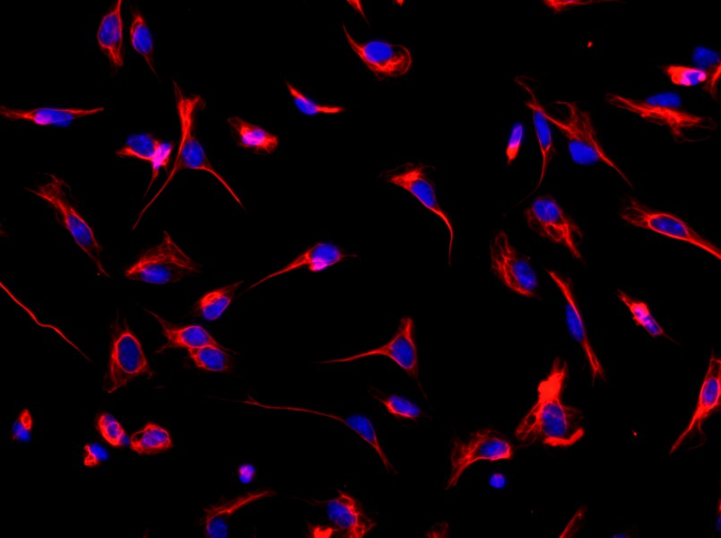 Mouse Cardiac Fibroblast Complete Medium - 2
