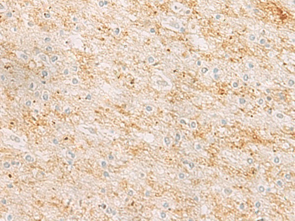 Immunohistochemistry of paraffin-embedded Human brain tissue  using RHCG Polyclonal Antibody at dilution of 1:25(?200)