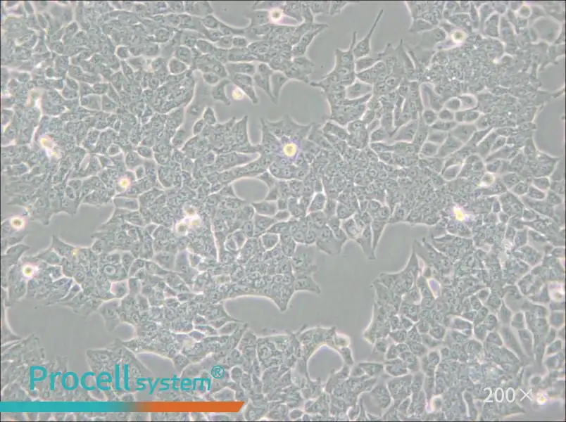 HCT 116 Cell Complete Medium - small - 5