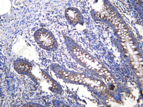 Recombinant NDUFB9 Monoclonal Antibody - 1