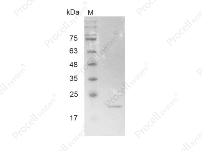 MMP7/MPSL1/PUMP-1, Human, Recombinant