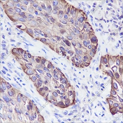 Recombinant Keratin 5/6 Monoclonal Antibody - 2