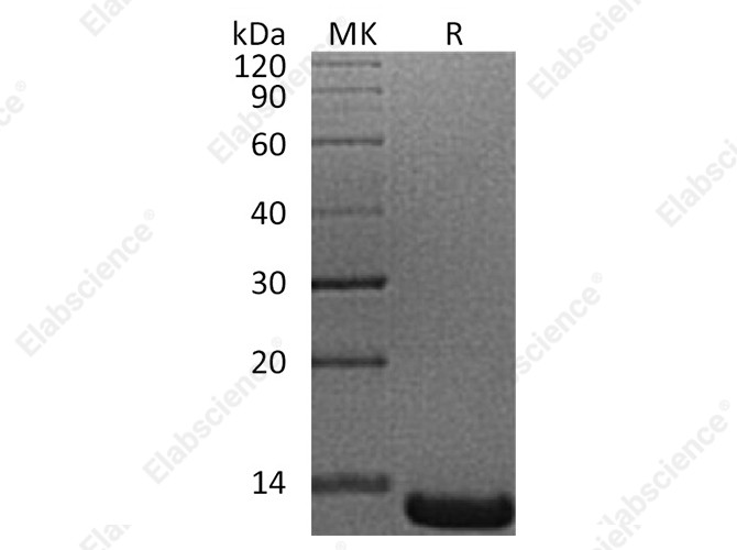 Recombinant Human ACYP1 Protein (His Tag) - 1