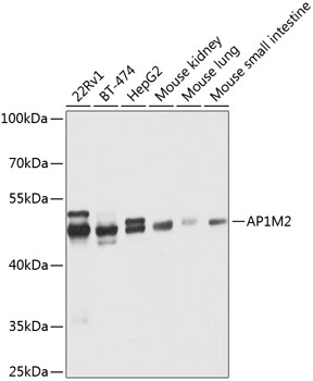 Western blot analysis of extracts of various cell lines using AP1M2 Polyclonal Antibody at 1:1000 dilution.