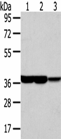 Western Blot analysis of Human fetal brain and placenta tissue, Mouse brain tissue using TALDO1 Polyclonal Antibody at dilution of 1/400