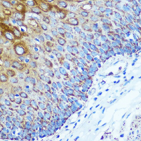 Immunohistochemistry of paraffin-embedded Human esophageal using WWC1 Polyclonal Antibody at dilution of 1:100 (40x lens).Perform microwave antigen retrieval with 10 mM PBS buffer pH 7.2 before commencing with IHC staining protocol.