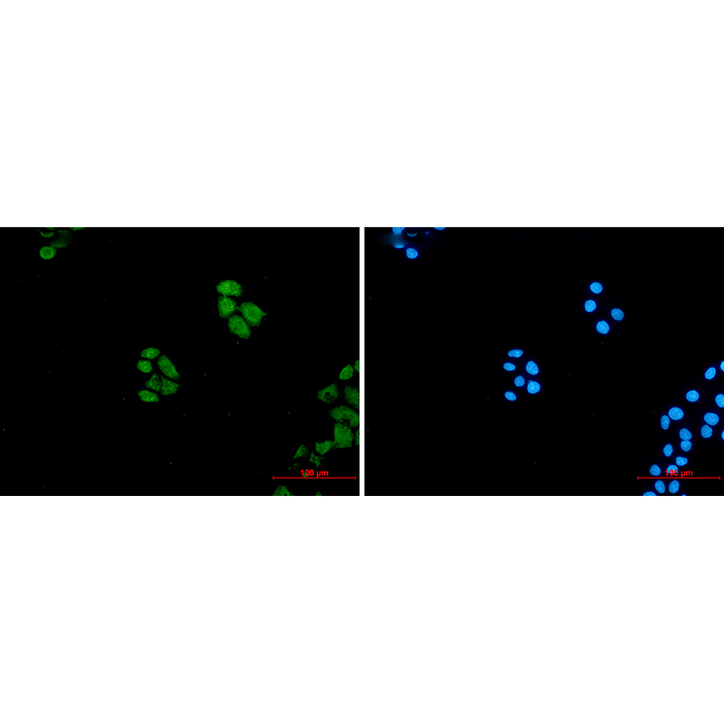 Immunofluorescence of Wnt5a  (green) in hela using Wnt5a Rabbit mAb at dilution 1:50, and DAPI(blue)