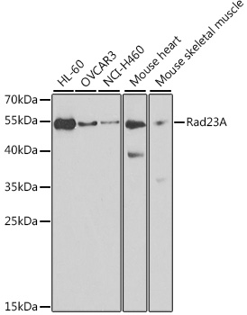 Western blot analysis of extracts of various cell lines using Rad23A Polyclonal Antibody at 1:1000 dilution.