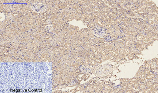 Immunohistochemistry of paraffin-embedded Rat kidney tissue using CD23 Monoclonal Antibody at dilution of 1:200.