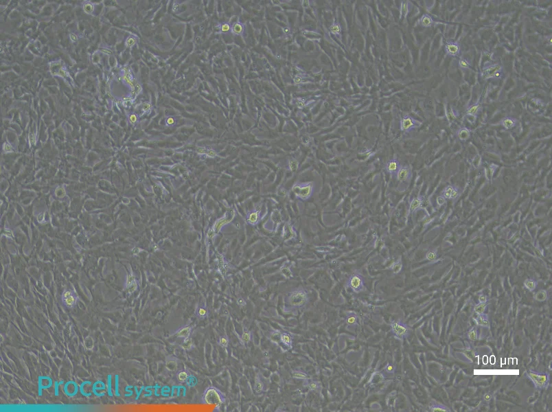 Rat Meningeal Fibroblast Complete Medium - 2