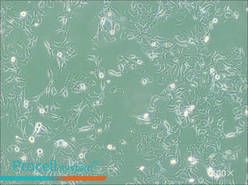 KYSE-410 Cell Complete Medium - 1