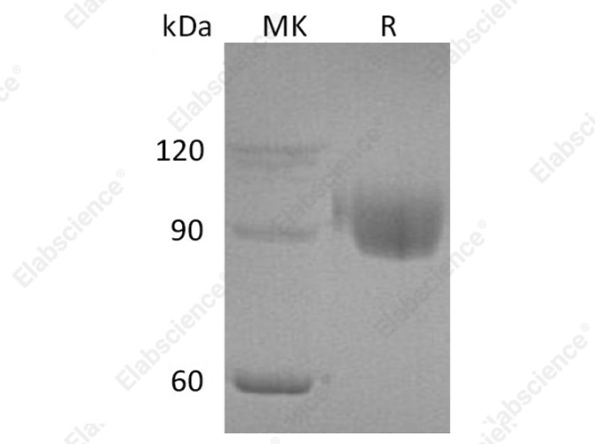 Recombinant Human PIGR Protein (His Tag) - 1