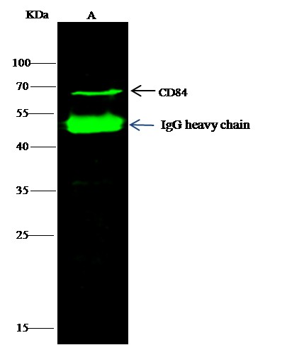 Recombinant CD84/SLAMF5 Monoclonal Antibody - small - 1