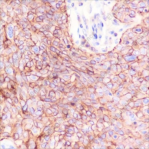 Recombinant Na+/K+ ATPase alpha-1 Monoclonal Antibody - 2