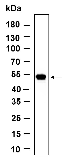 Recombinant LOX Monoclonal Antibody-searchlist-1