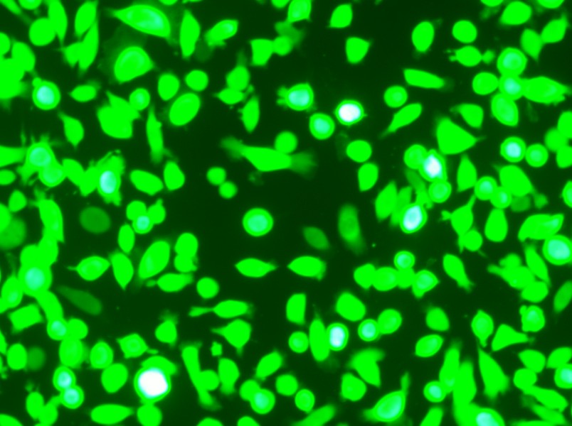 AGS-GFP Cell Complete Medium - 5
