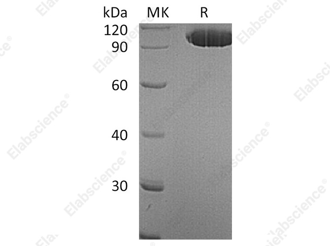 Recombinant Human EphA2 Protein (Fc Tag) - 1