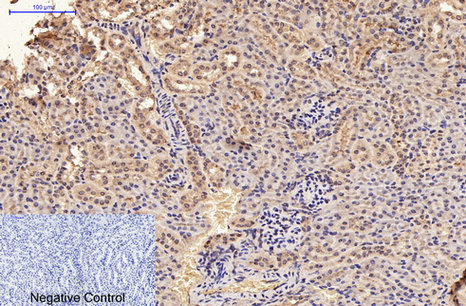 Immunohistochemistry of paraffin-embedded Mouse kidney tissue using GFAP Monoclonal Antibody at dilution of 1:200.