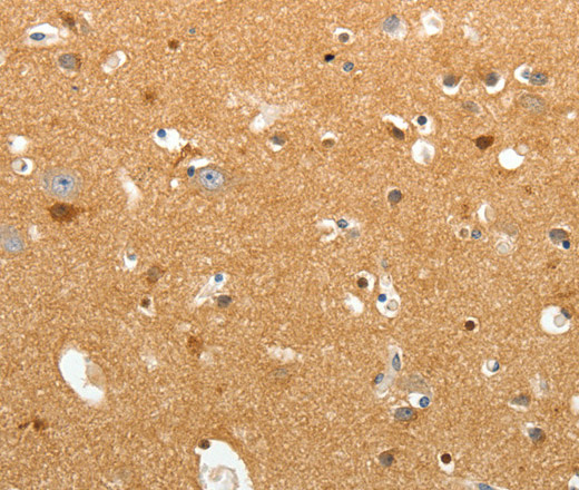 Immunohistochemistry of paraffin-embedded Human brain tissue using TNR Polyclonal Antibody at dilution 1:60