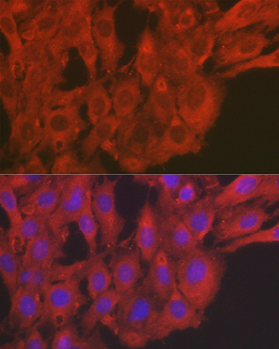 Immunofluorescence analysis of C6 cells using [KO Validated] SOD2 Polyclonal Antibody at dilution of 1:50 (40x lens). Blue: DAPI for nuclear staining.