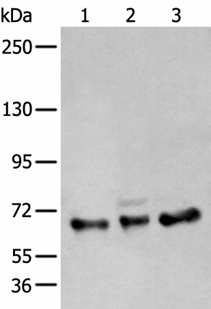 Western blot analysis of A431 K562 and TM4 cell lysates  using ZBTB5 Polyclonal Antibody at dilution of 1:400