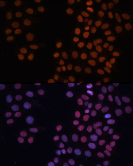 Immunofluorescence analysis of HeLa cells using HMGN1 Polyclonal Antibody at dilution of 1:100. Blue: DAPI for nuclear staining.